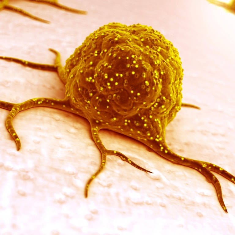 Es gibt neue, vielversprechende Ansätze im Kampf gegen Leberkrebs und Darmkrebs. Krebszelle (Illustration)